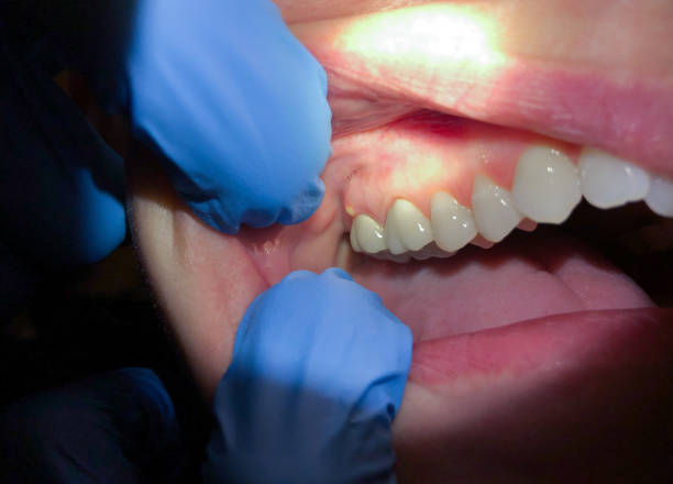 Best Broken or Chipped Tooth Repair in Mystic, CT